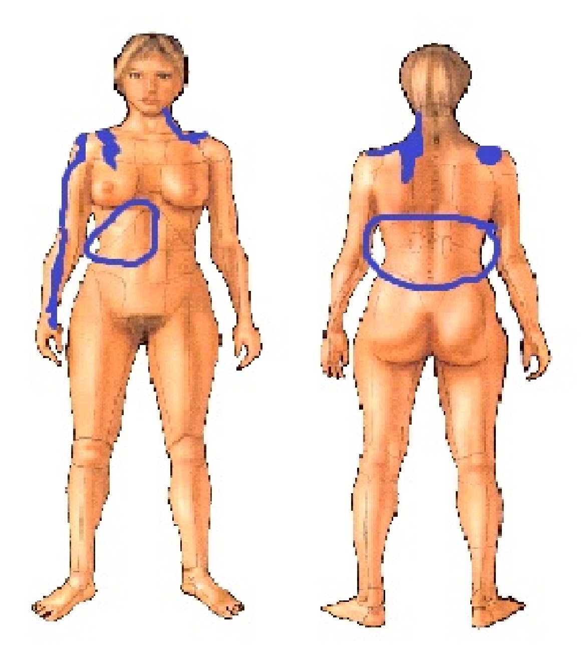 Como se llama el médico la osteocondrosis que cura